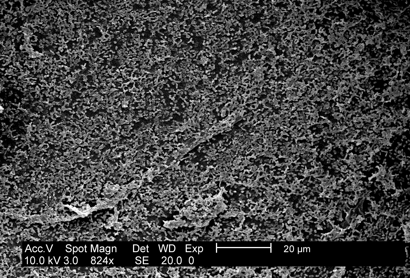 What Is Biofilm? Disinfect Tips